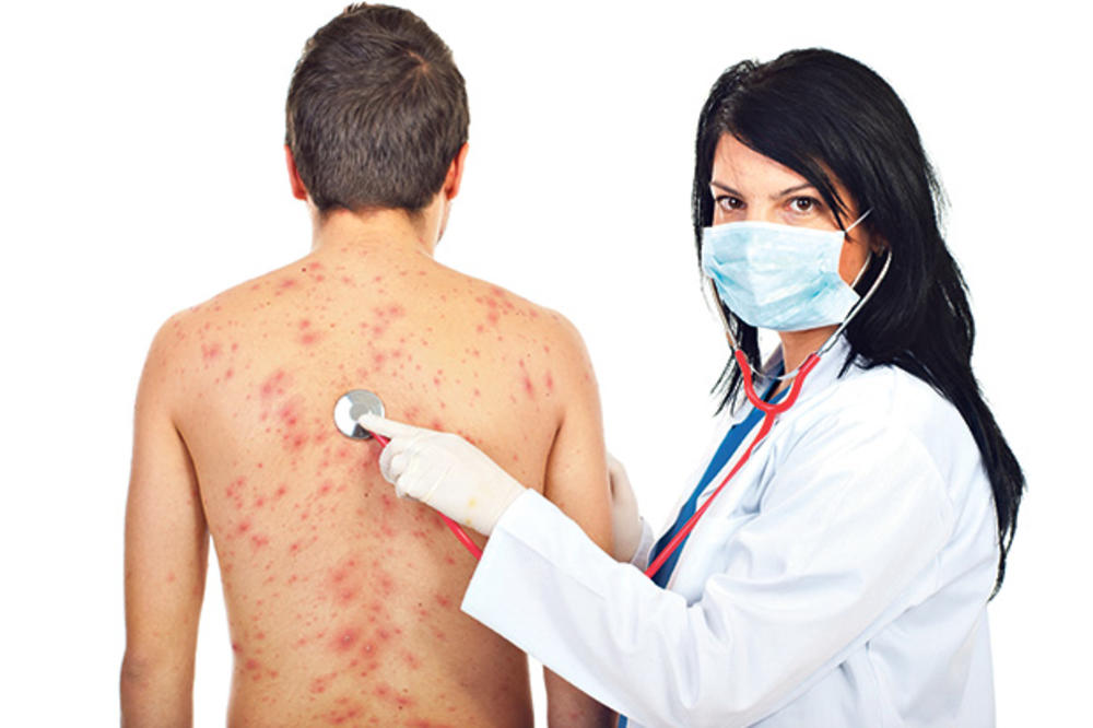 1358967_stockphotodoctorwomanexaminepatientmalewithchickenpoxisolatedonwhitebackground66426889_ls