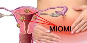 miomi
