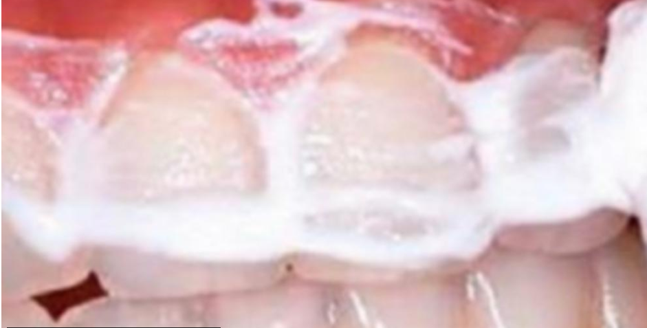 as