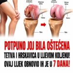 Potpuno joj bila oštećena TETIVA i HRSKAVICA u lijevom koljenu! Ovaj lijek obnovio ih je u 7 dana! (RECEPT)
